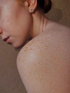 Die Dermatologie beschäftigt sich mit dem größten Organ des Menschen: Der Haut.